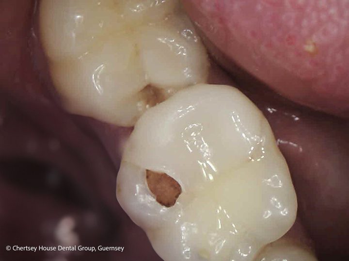 Chertsey House Implants
